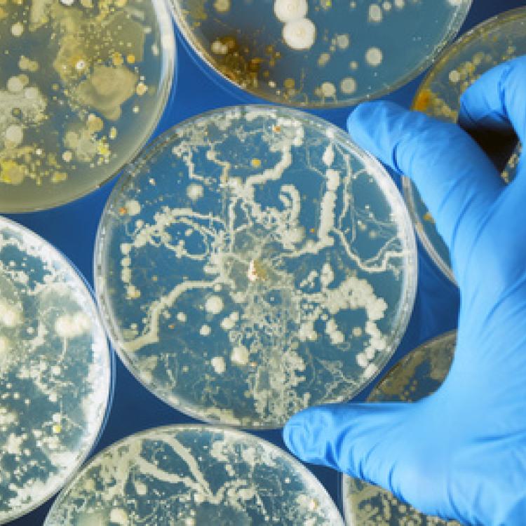Gloved hand holding bacteria growing in a petri dishes