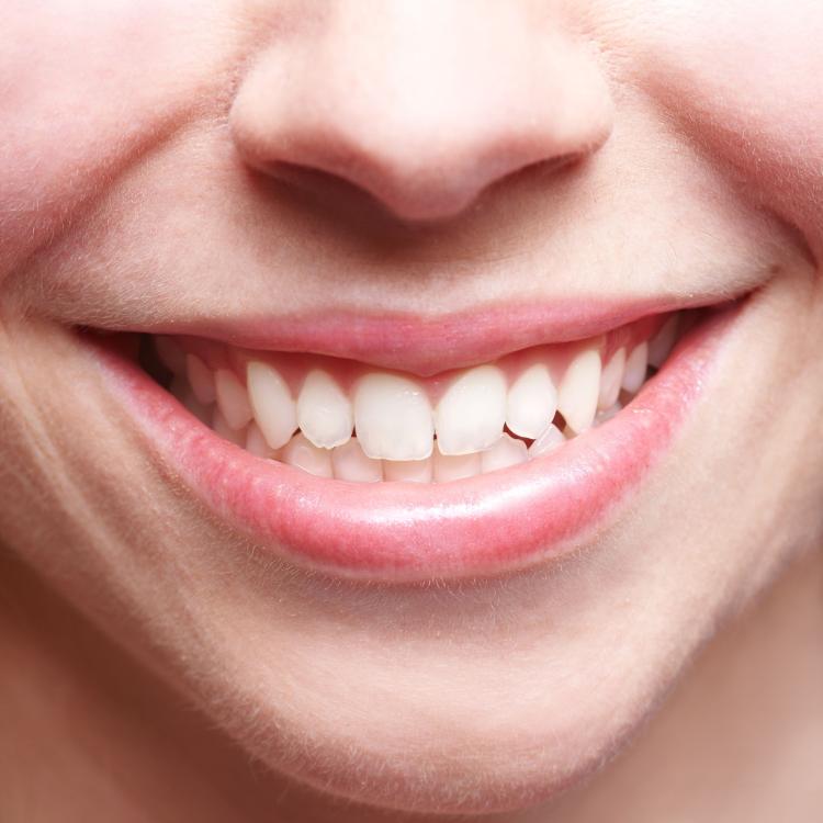 14754696 - close-up of smiling female mouth with bright teeth showing