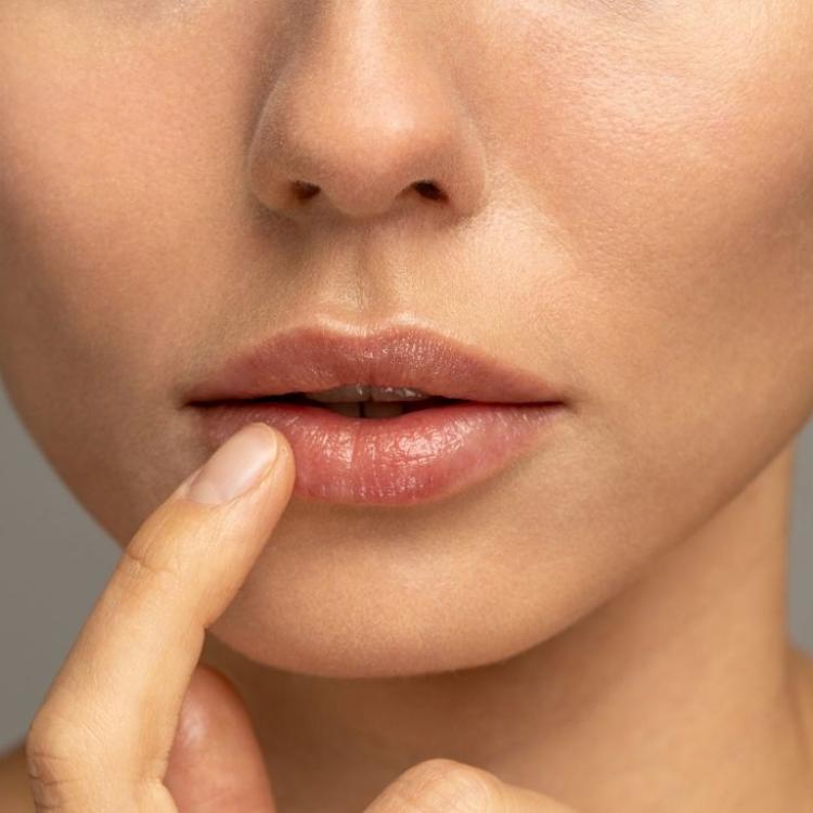 Wystarczy spadek odporności, osłabienie czy stres, by opryszczka pojawiła się w okolicach ust lub nosa. (Fot. iStock)